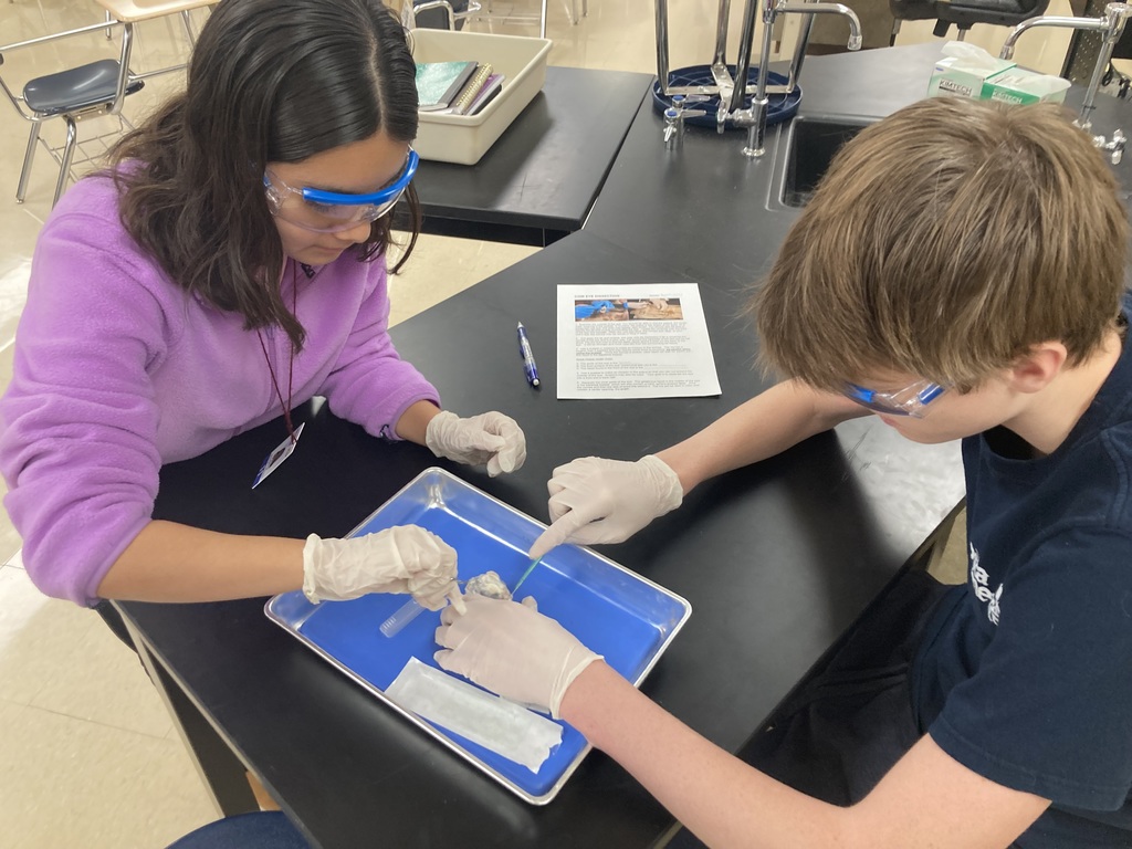 Eyeball Dissection