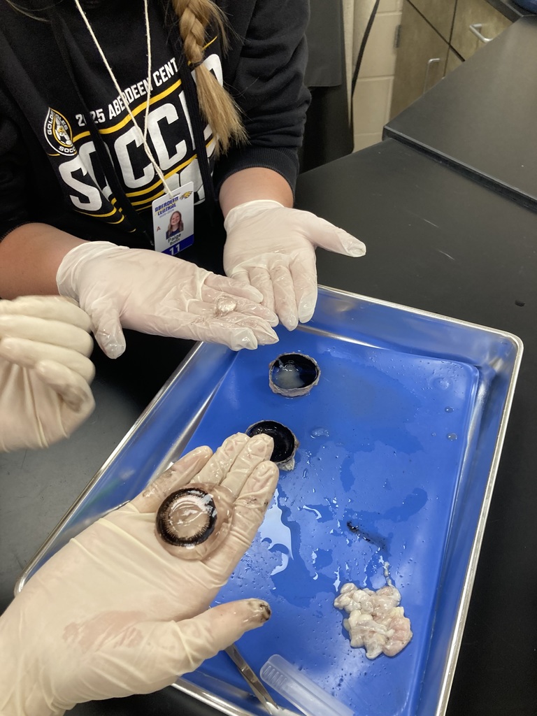 Eyeball Dissection