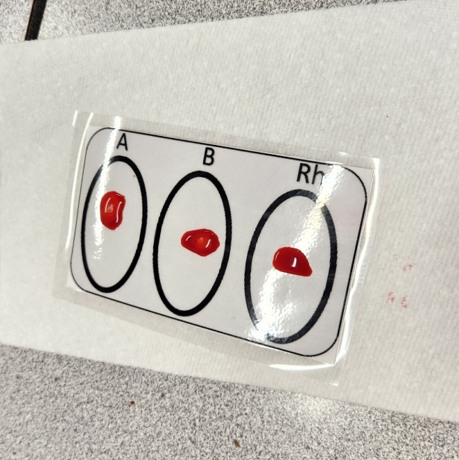 "Blood" sample 