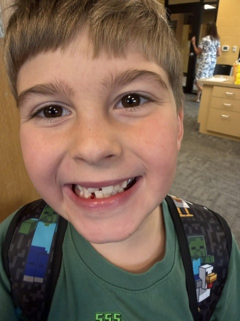 missing tooth