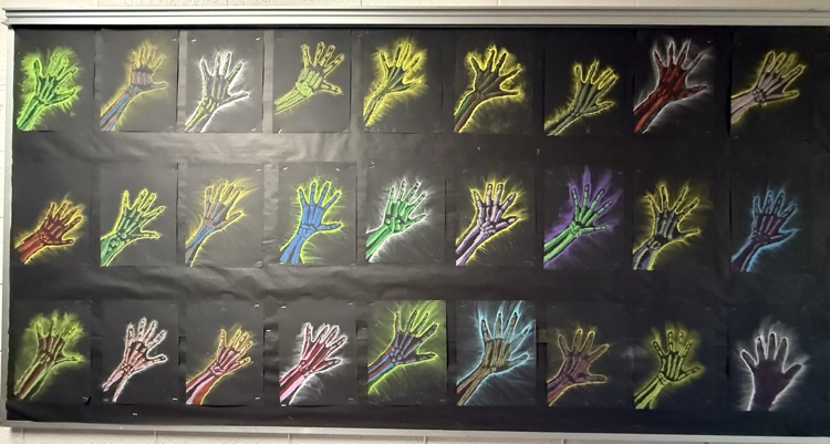 hands