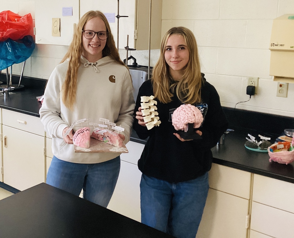 3D printed brain model