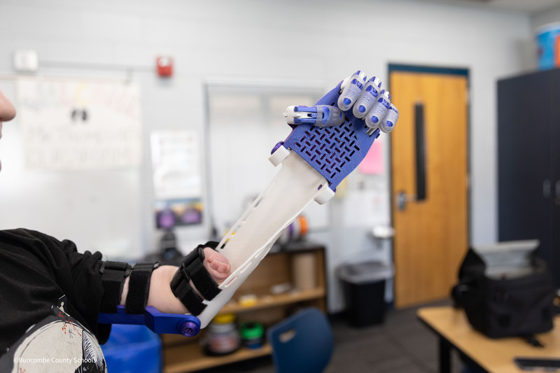 prosthetic arm