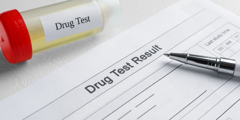 drug testing