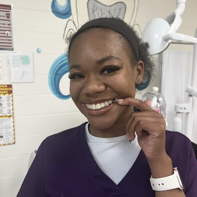 student smiling with tooth gems