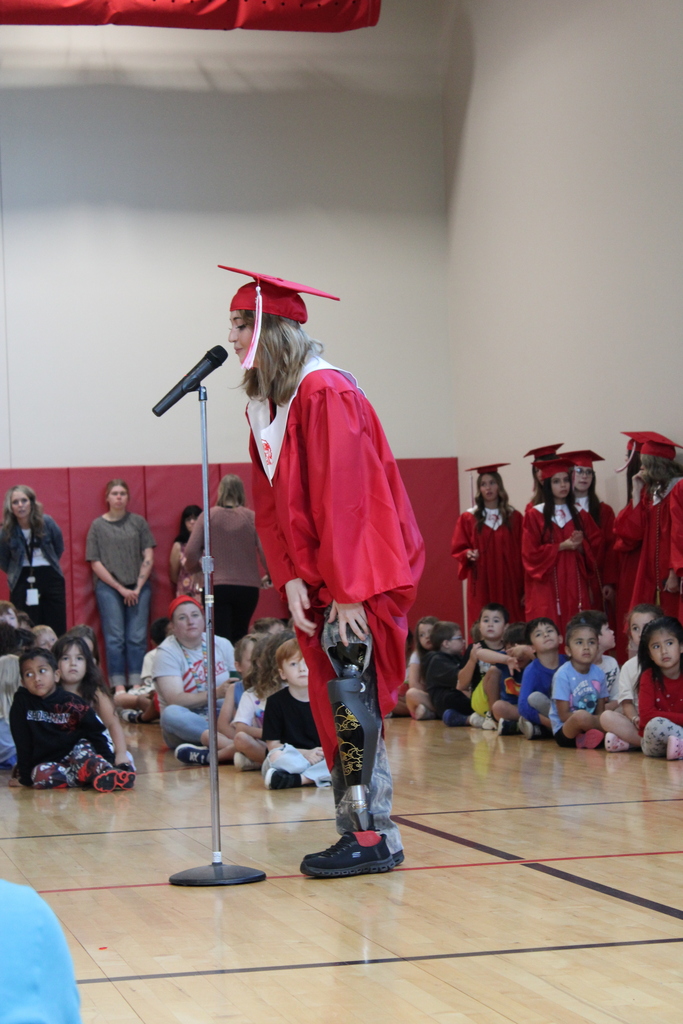 student showing prosthetic leg