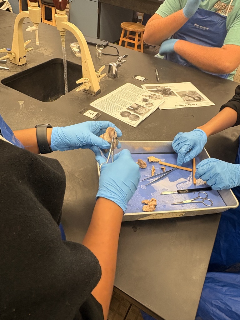 Ms. Andersen’s Anatomy & Physiology students took a deep dive into the structure and function of the human eye through a cow eye dissection. Using a cow eye, whose structures closely resemble those of the human eye, students identified key anatomical features. They made real-world connections between structure and function, bringing textbook concepts to life.