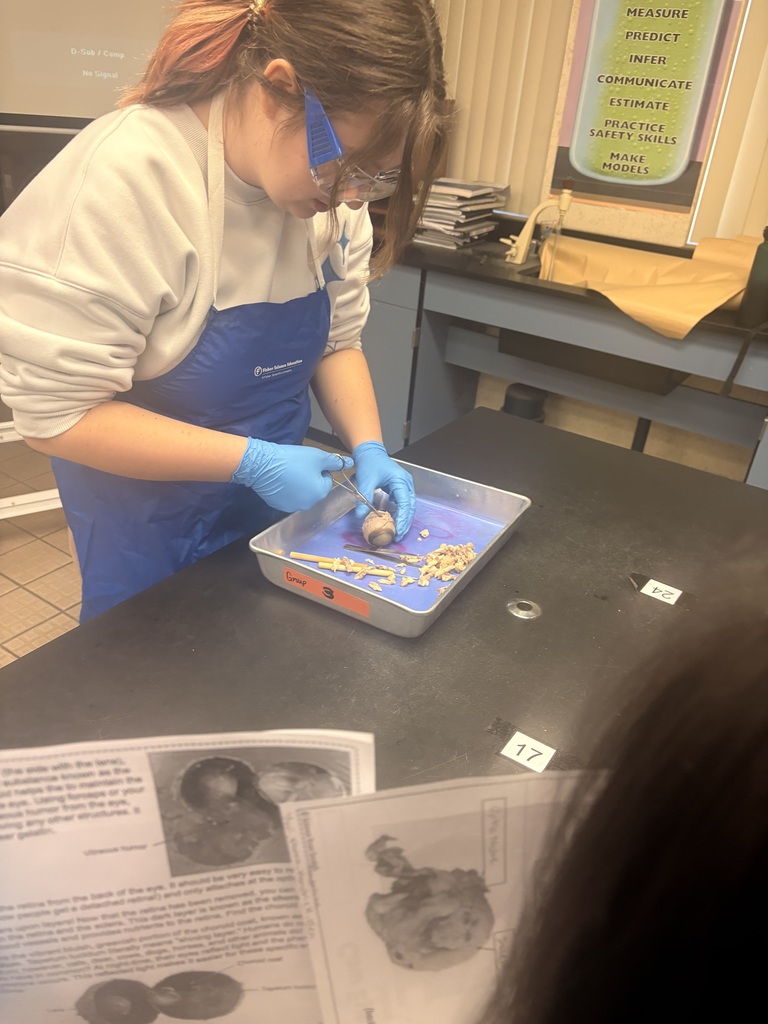 Ms. Andersen’s Anatomy & Physiology students took a deep dive into the structure and function of the human eye through a cow eye dissection. Using a cow eye, whose structures closely resemble those of the human eye, students identified key anatomical features. They made real-world connections between structure and function, bringing textbook concepts to life.
