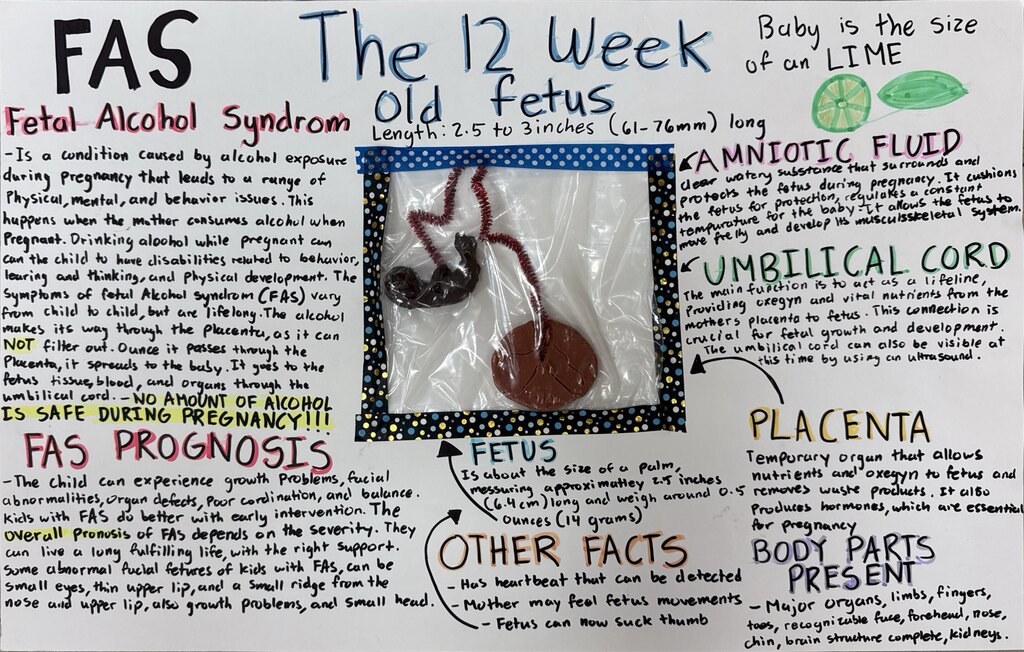 Students in Mrs. Craig’s Human Growth & Development class created their own fetus models using clay, a pipe cleaner, and a Ziploc bag, carefully considering the size, appearance, and developmental stage of a real fetus.