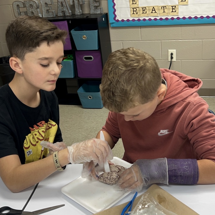 “Wrapping up our mini brain unit with hands-on discovery! 🧠 Students explored real sheep brains through dissection and then applied their learning by building creative neuron models to show how messages travel in the brain.”