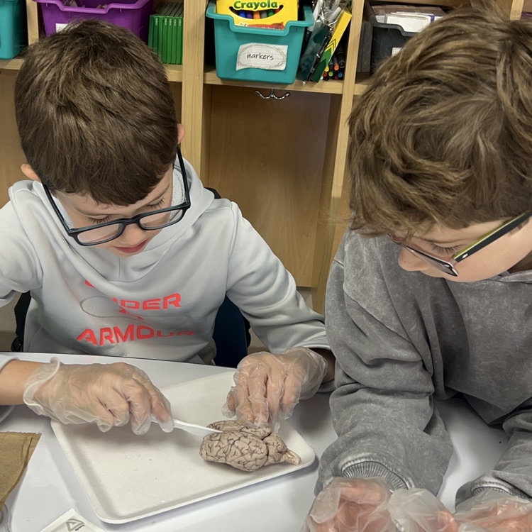 “Wrapping up our mini brain unit with hands-on discovery! 🧠 Students explored real sheep brains through dissection and then applied their learning by building creative neuron models to show how messages travel in the brain.”