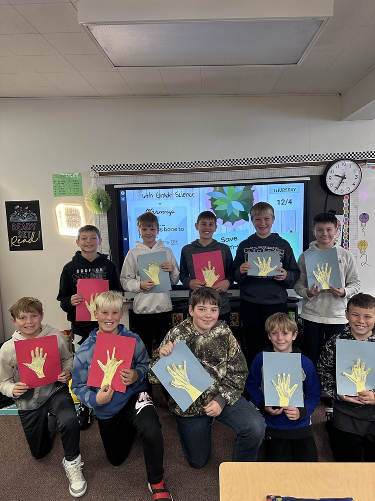 6th boys with model hands