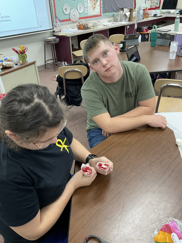 muscle fiber models