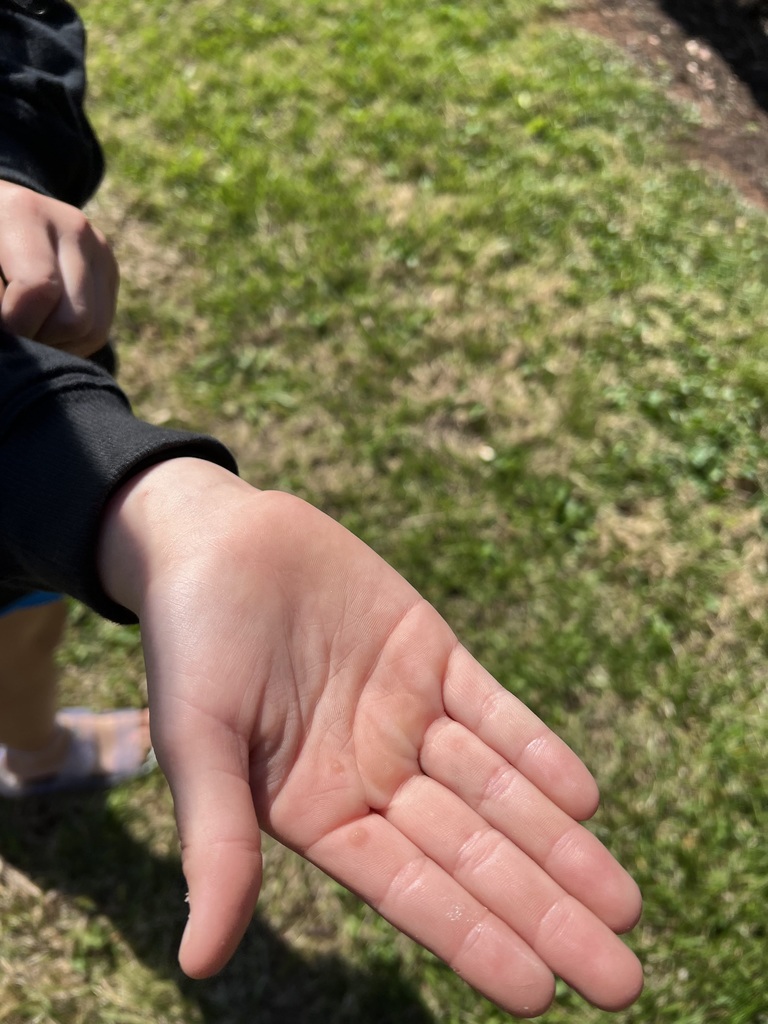 Close-up of a child’s open hand holding a tiny round object, possibly an egg or small insect, with grass in the background.