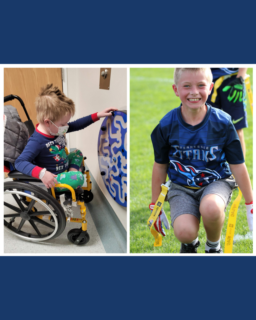 A collage of two photos of Leo before and during treatment. 