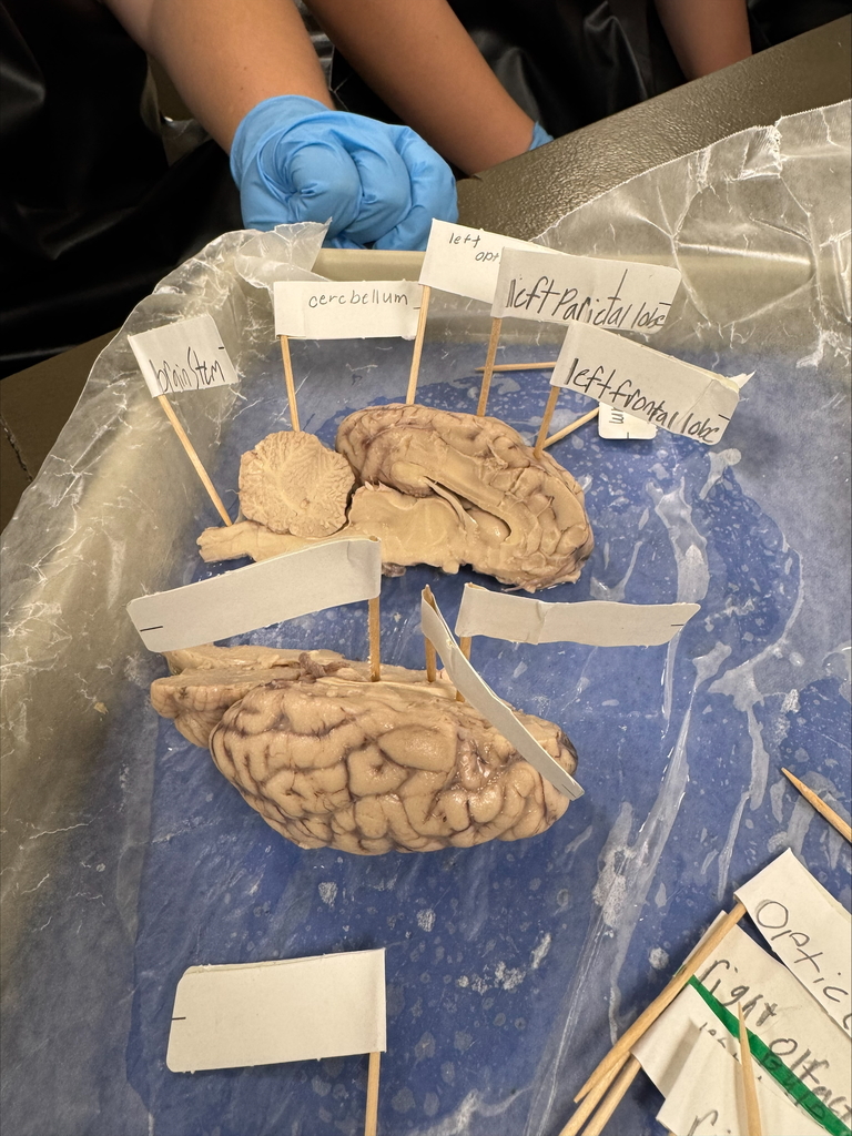 Labeled parts of the sheep brain.