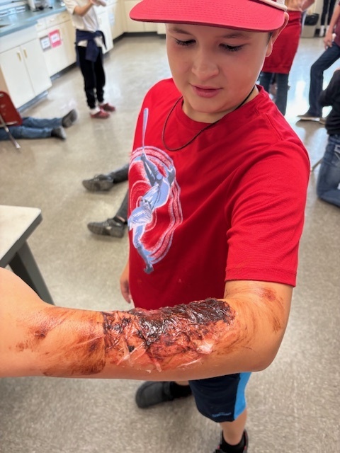 6th grade 1st aid 3