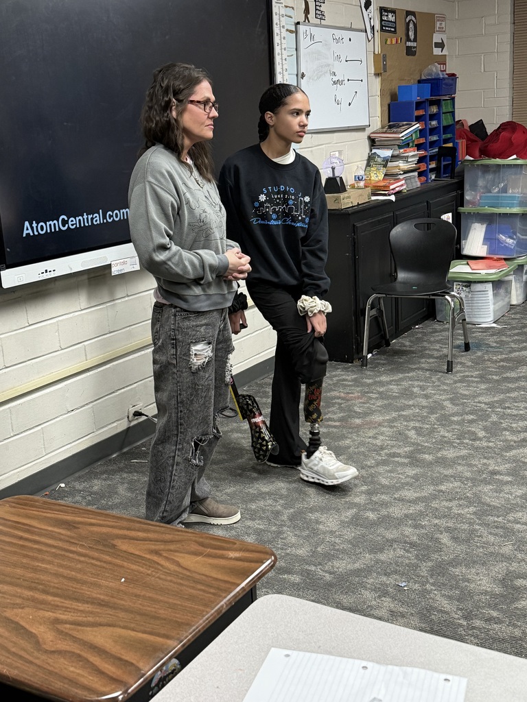 student with prosthetic leg