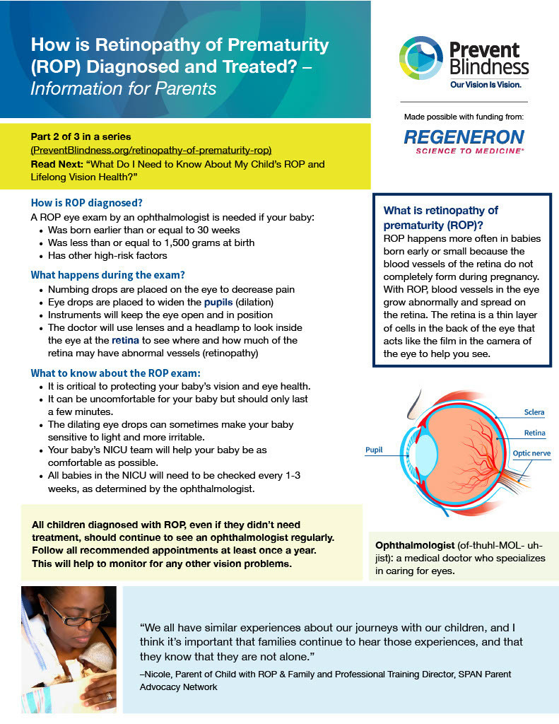 How is ROP diagnosed and treated?