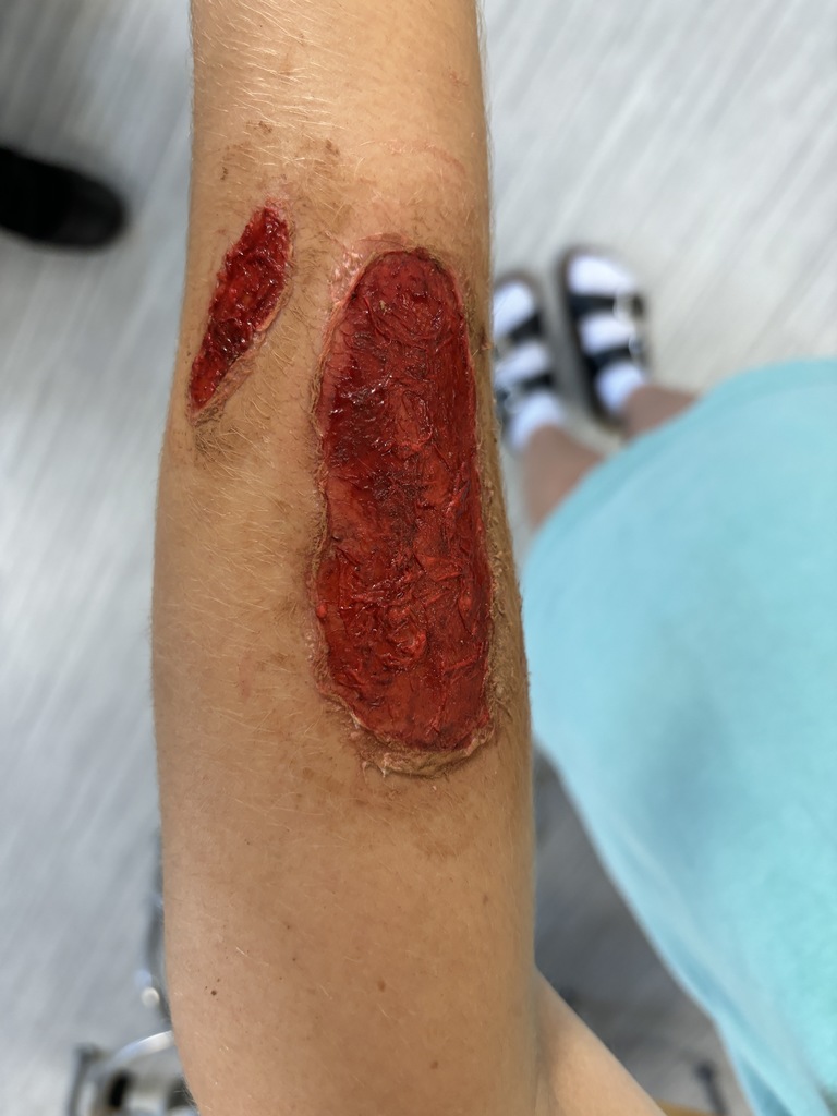 Fake Wound
