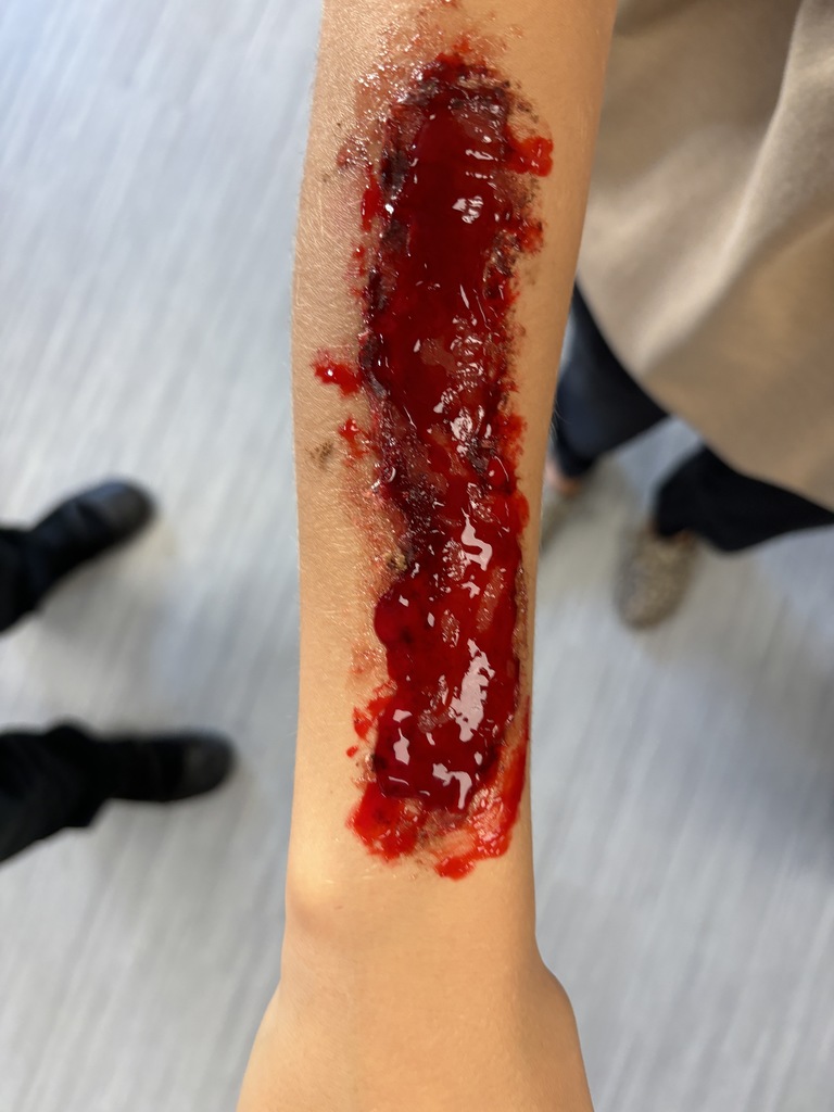 Fake Wound