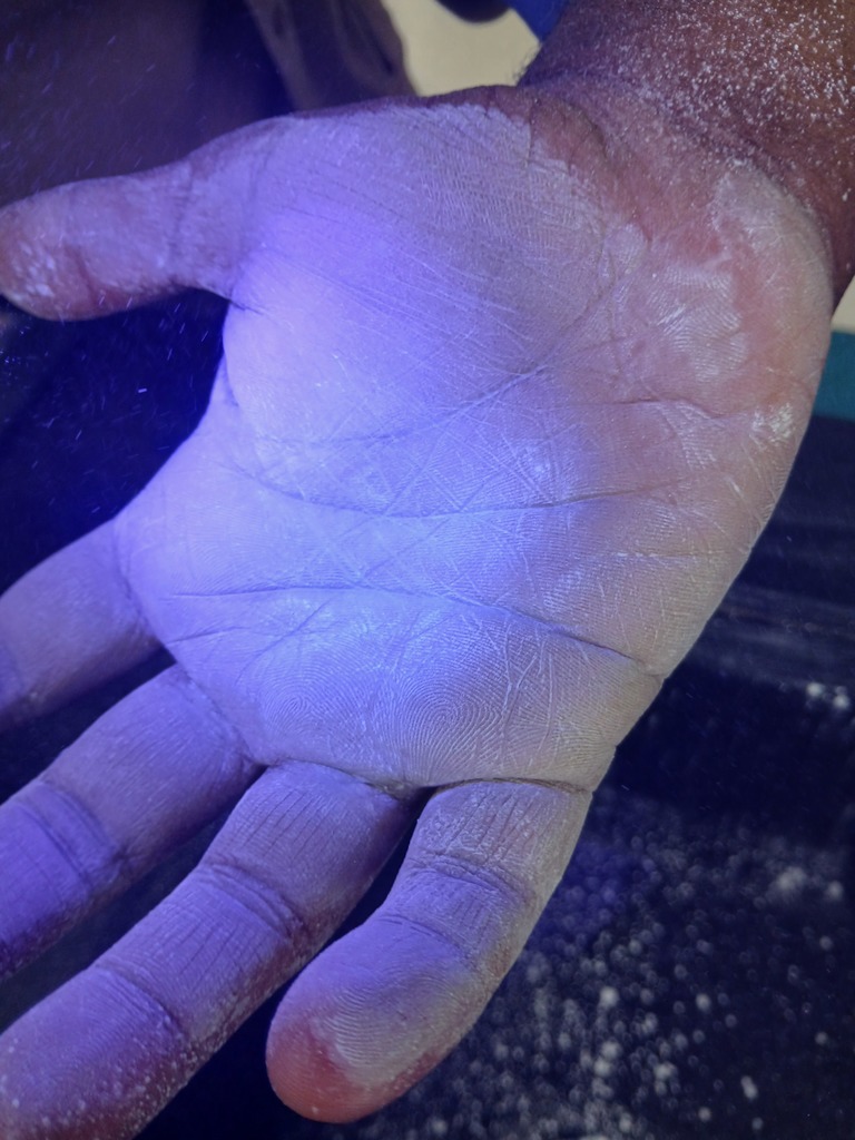 Glow Germs before hands are washed.