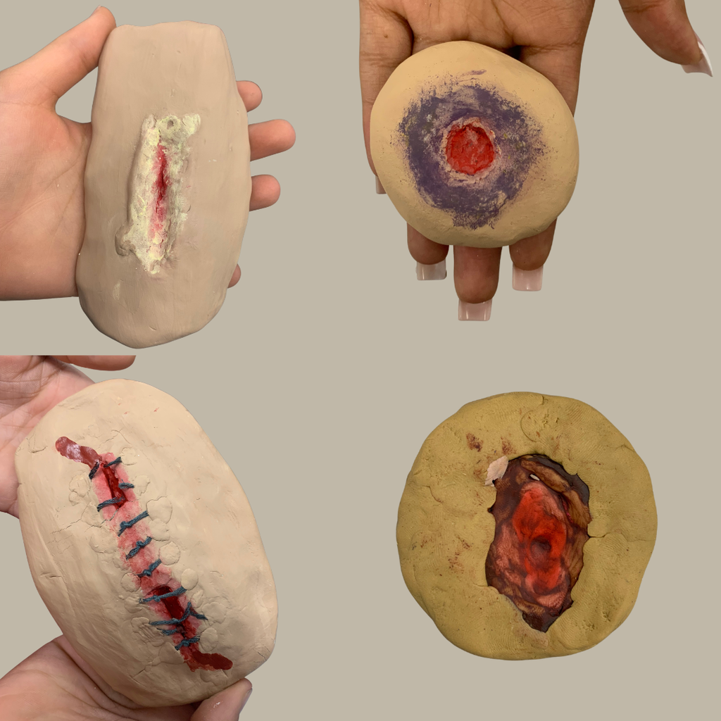 A collage of four hands holding different beige clay models created by students to represent various medical wounds. Clockwise from top left: a laceration with greenish pus, a round puncture wound surrounded by deep purple bruising, an open ulcerated wound with raw red tissue, and a long incision neatly held together with blue surgical sutures.