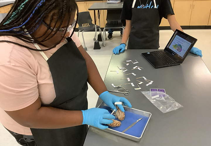 sheep brain dissection