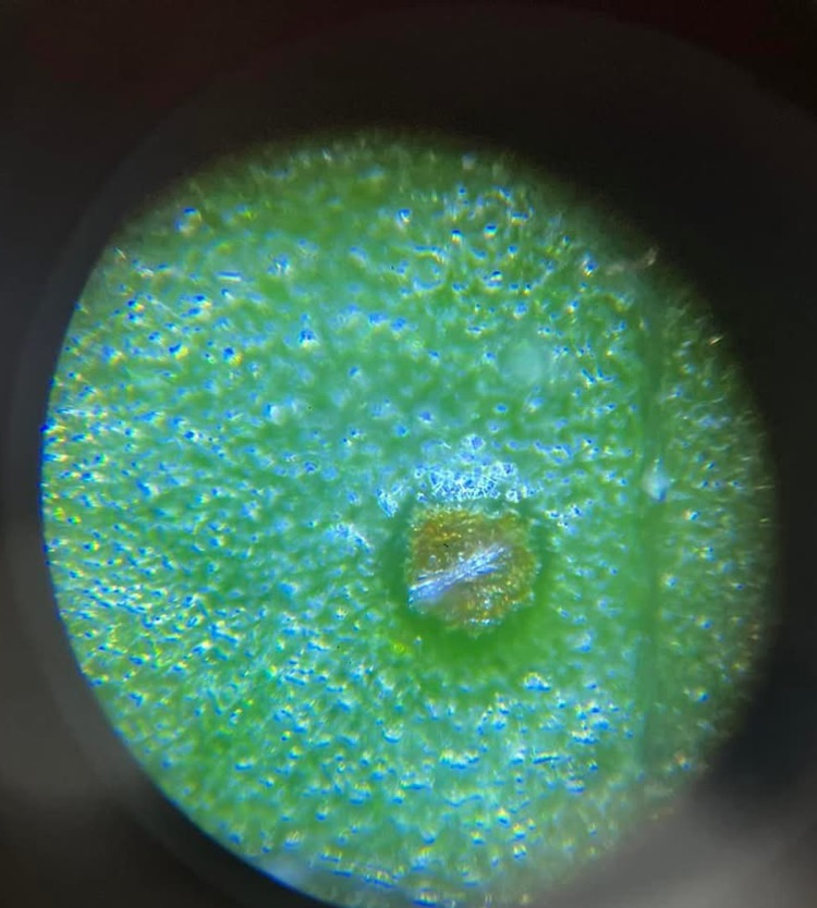 hydroponics pictures