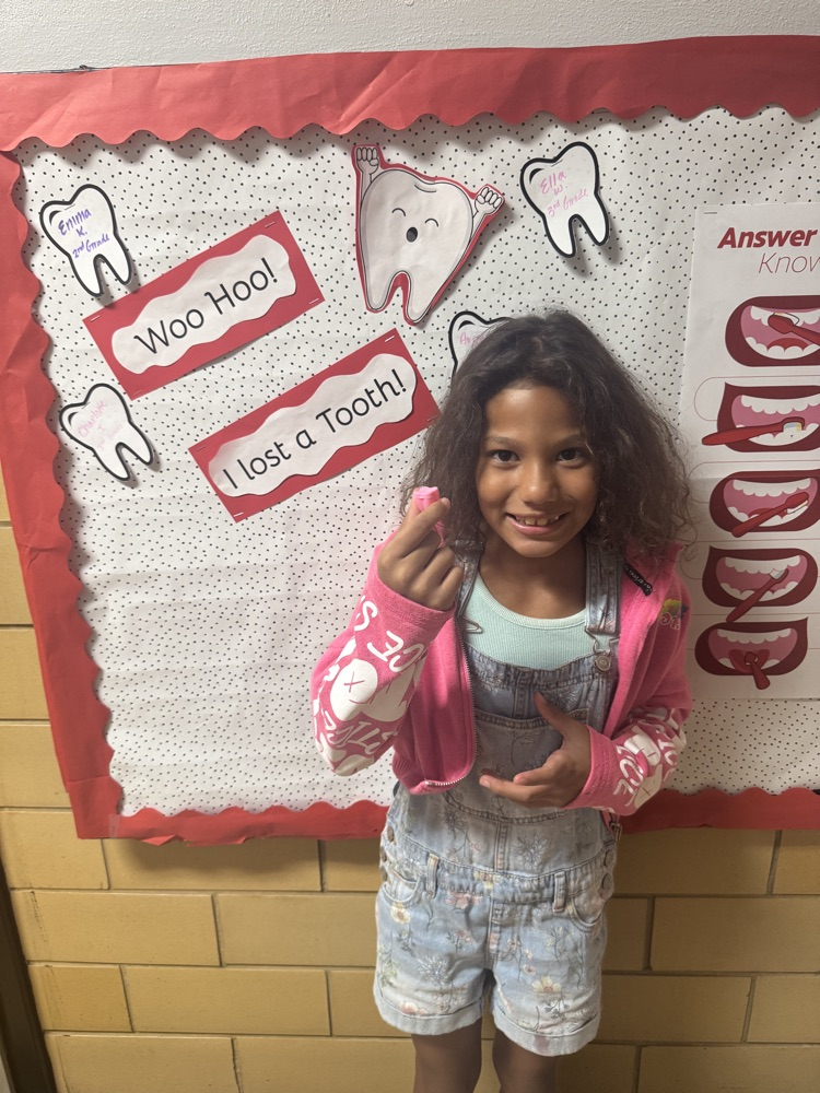 student who lost a tooth