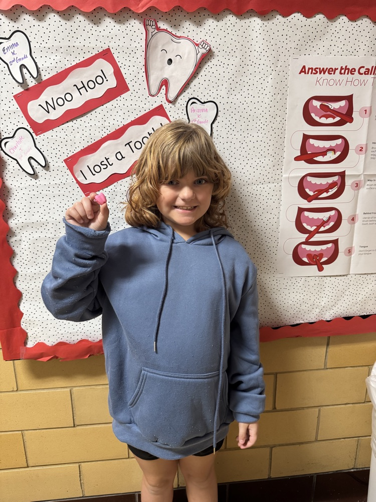 student who lost a tooth