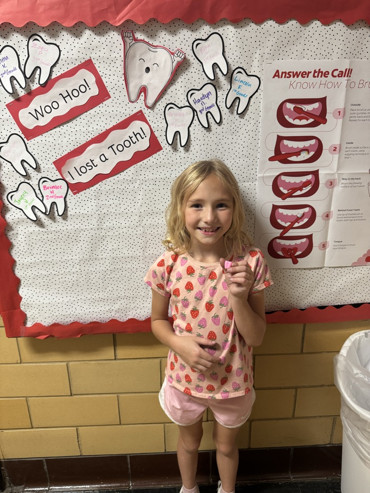 student who lost a tooth