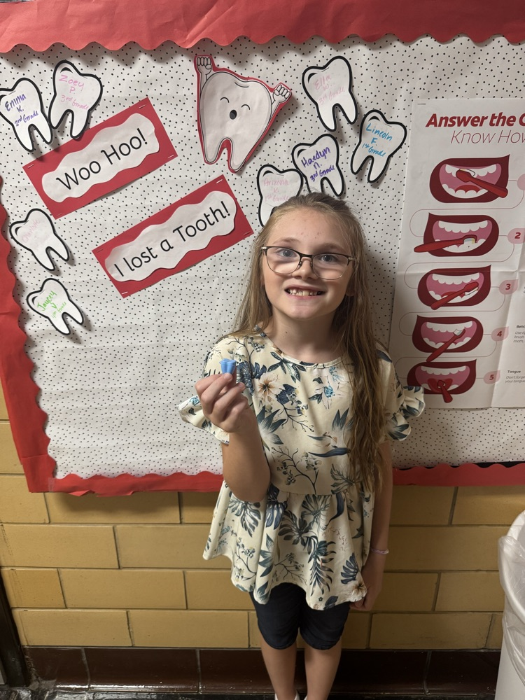 student who lost a tooth