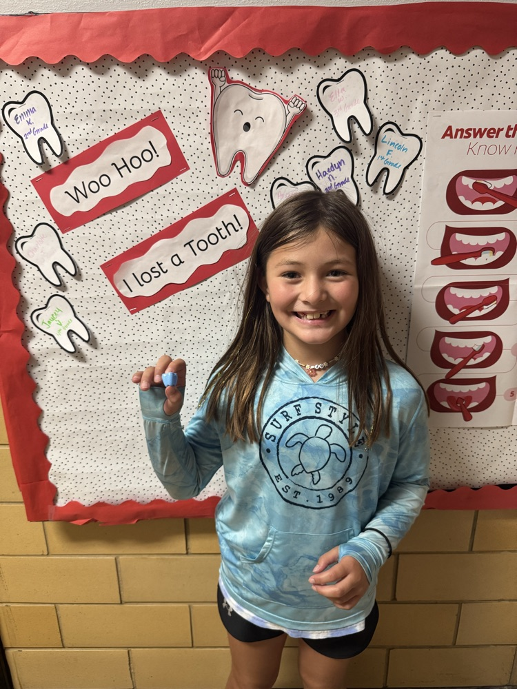 student who lost a tooth