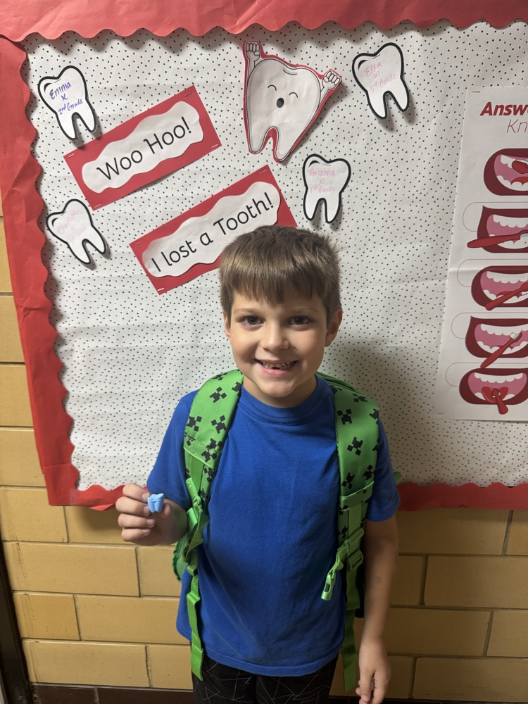 student who lost a tooth