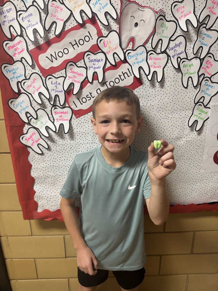 lost tooth students!