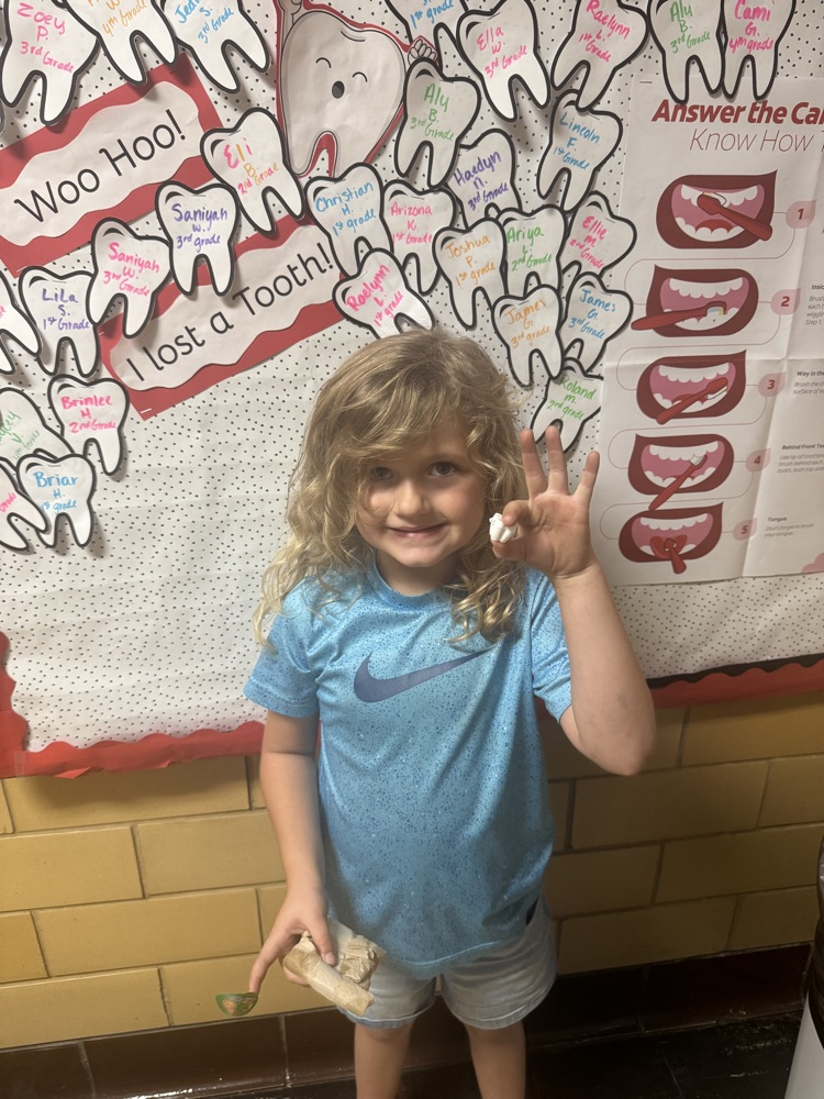I lost a tooth at school! 