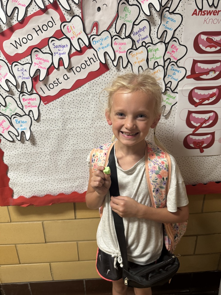 I lost a tooth at school! 