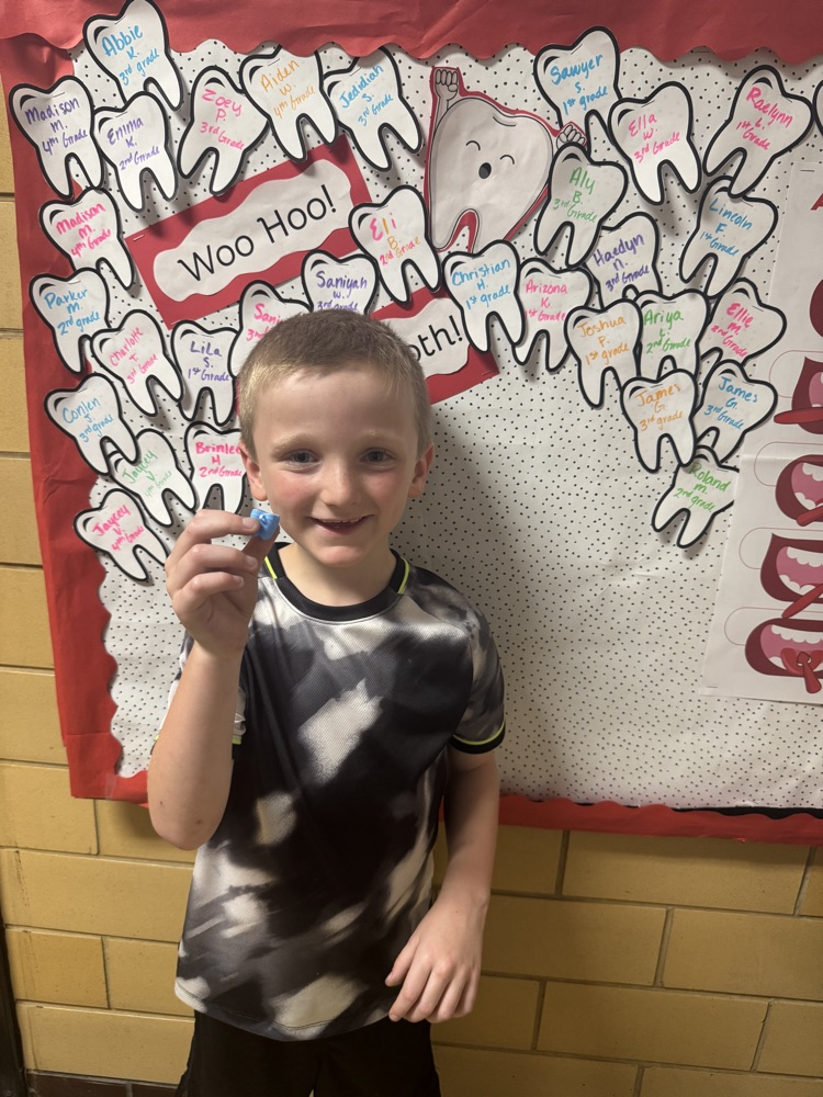 I lost a tooth at school! 
