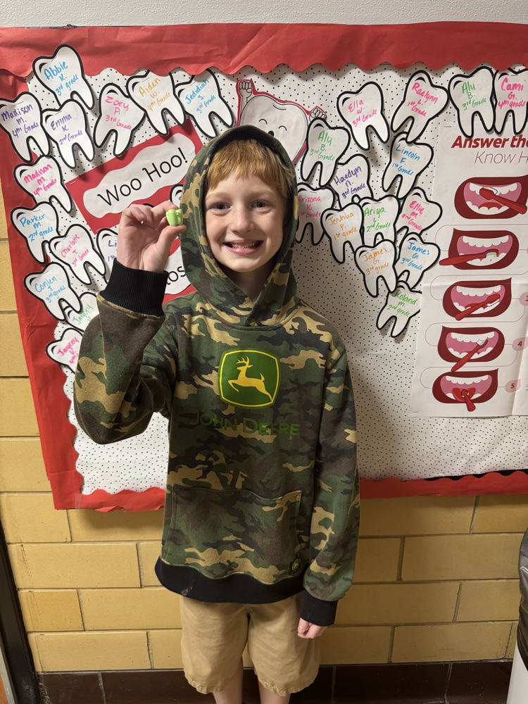 I lost a tooth at school! 