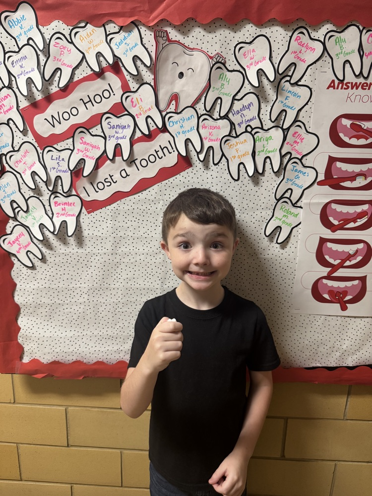 I lost a tooth at school! 