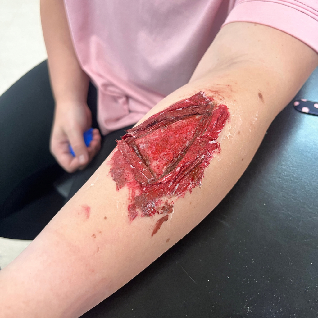 Mrs. Lee's Allied Health Student practicing sterile wound care