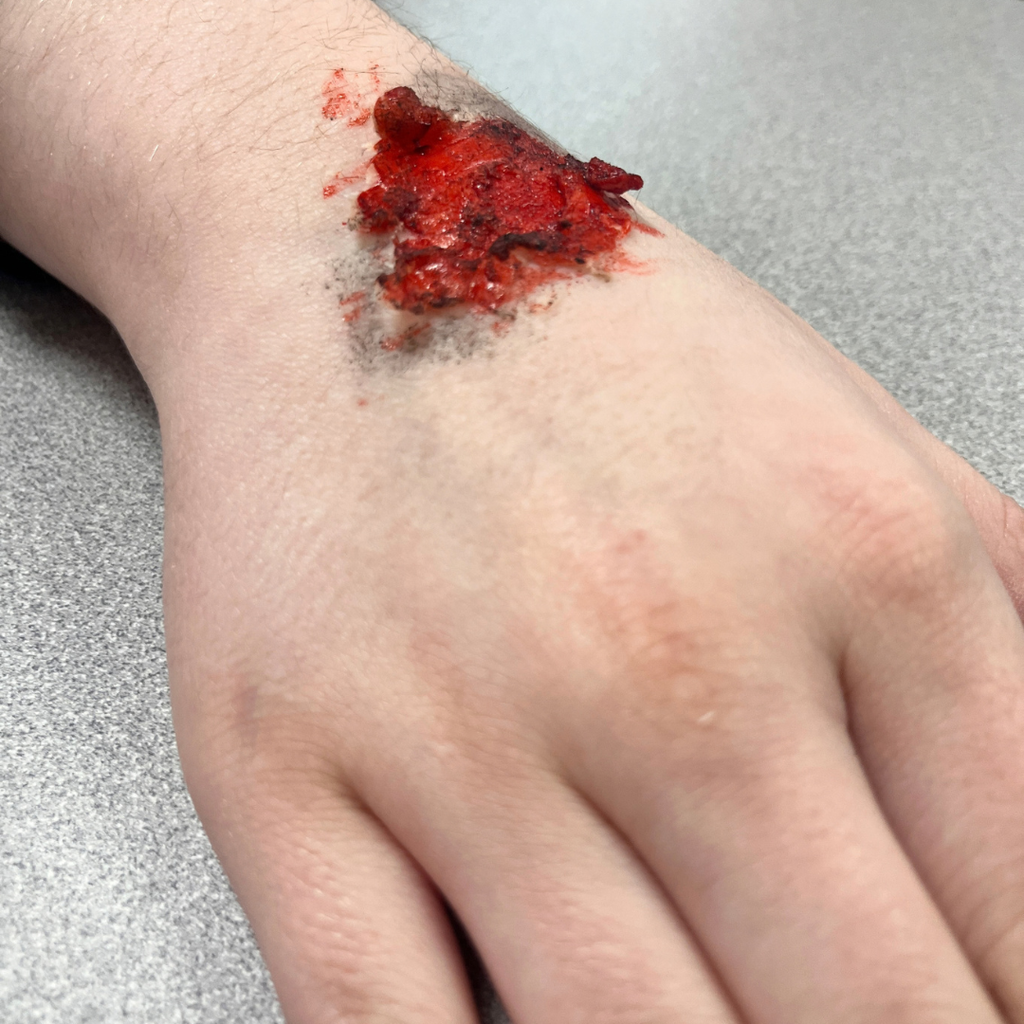 Mrs. Lee's Allied Health Care students practicing sterile wound care techniques