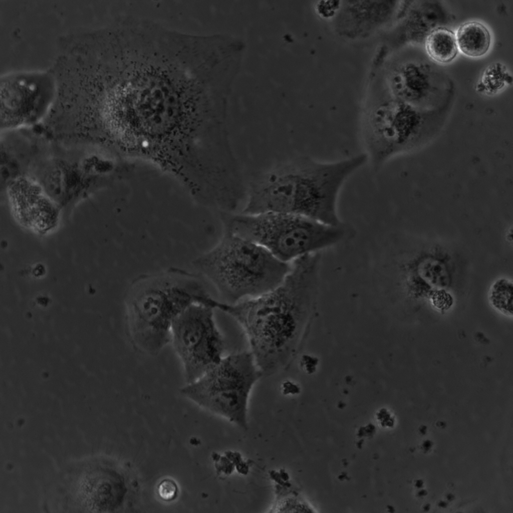 Image from microscope