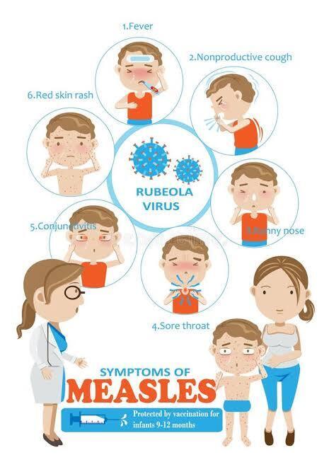 Measles Information