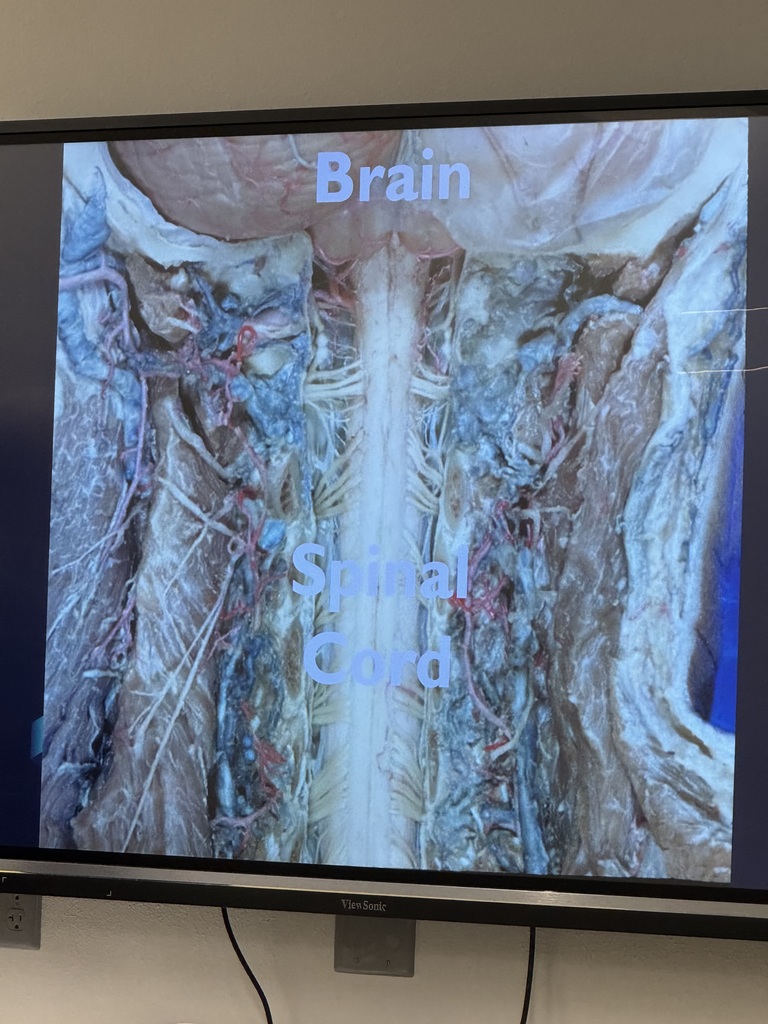 Dr. Stacy Carlin presenting on bones and nerves