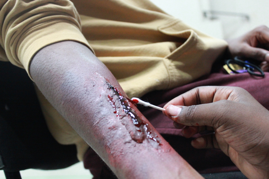 paint beinf applied to an arm with a qtip to make it look like a wound