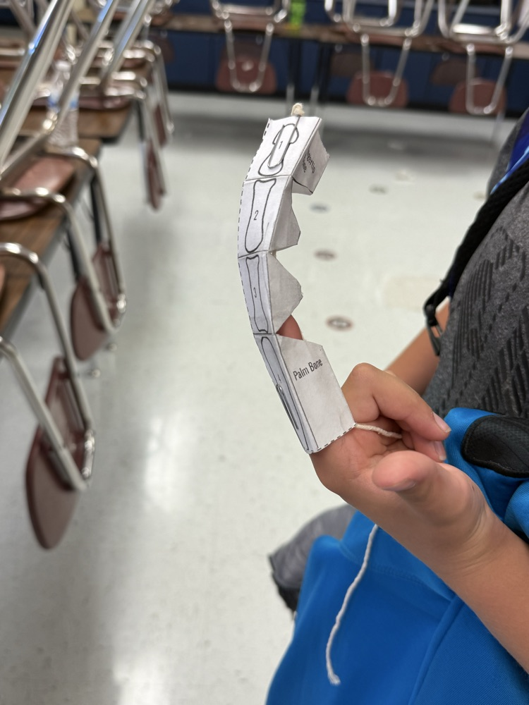 The robotic finger