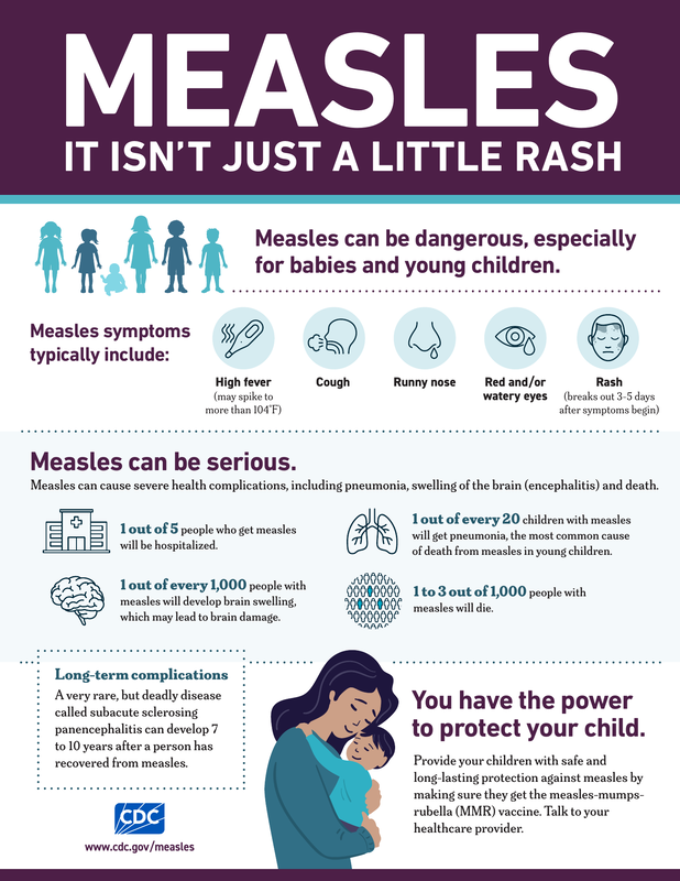 Measles Description 