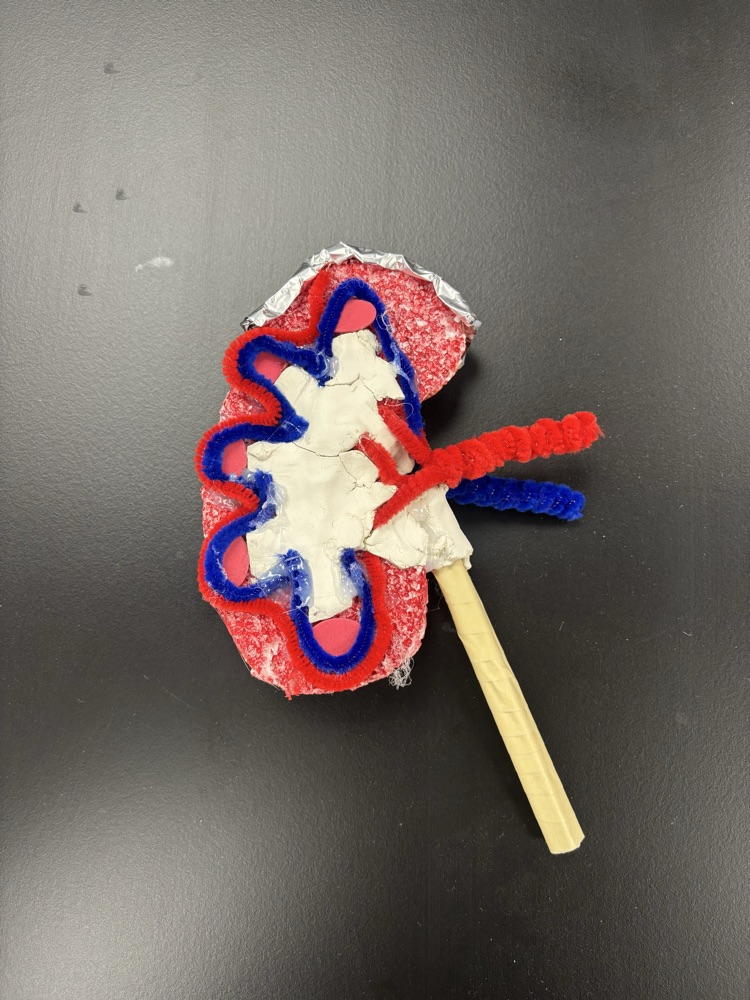 kidney model
